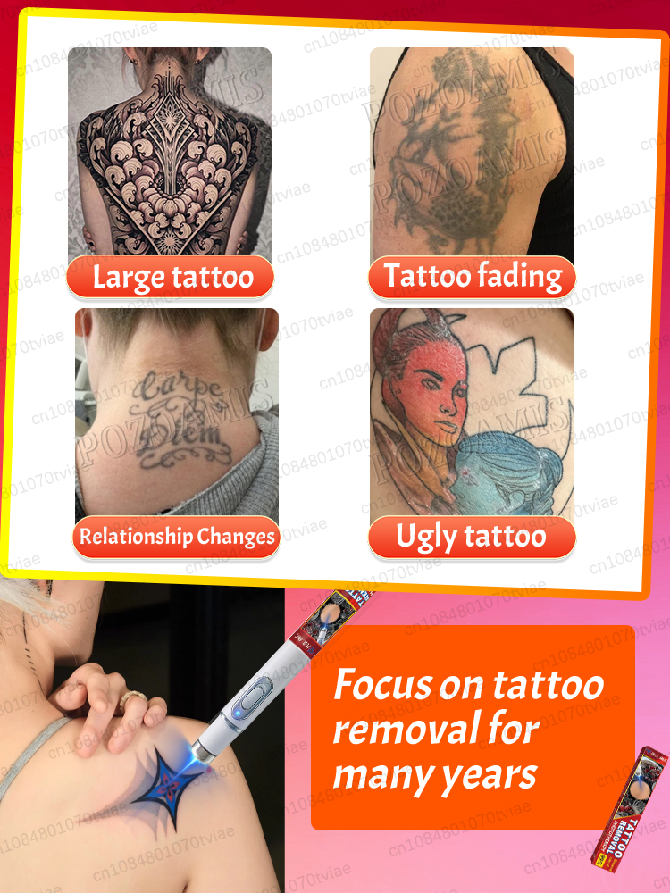 Nano-Laser-Tattooentfernungsst - Laser Toner Powder review and price
